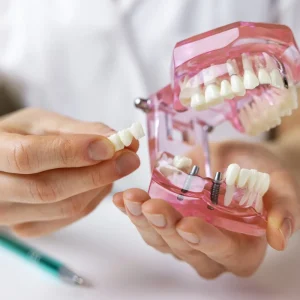 Dental Implant Courses | TCP Implant Marathon